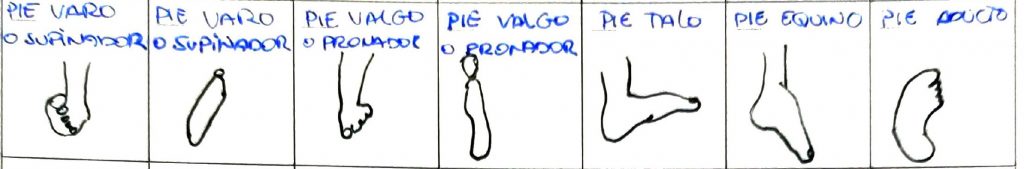deformaciones de los pies