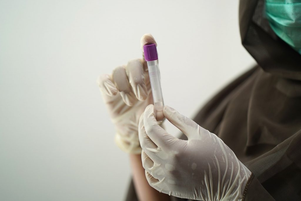 test prenatal para conocer el sexo del feto