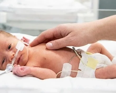 apoyo bebes prematuros politicas familias actualidad